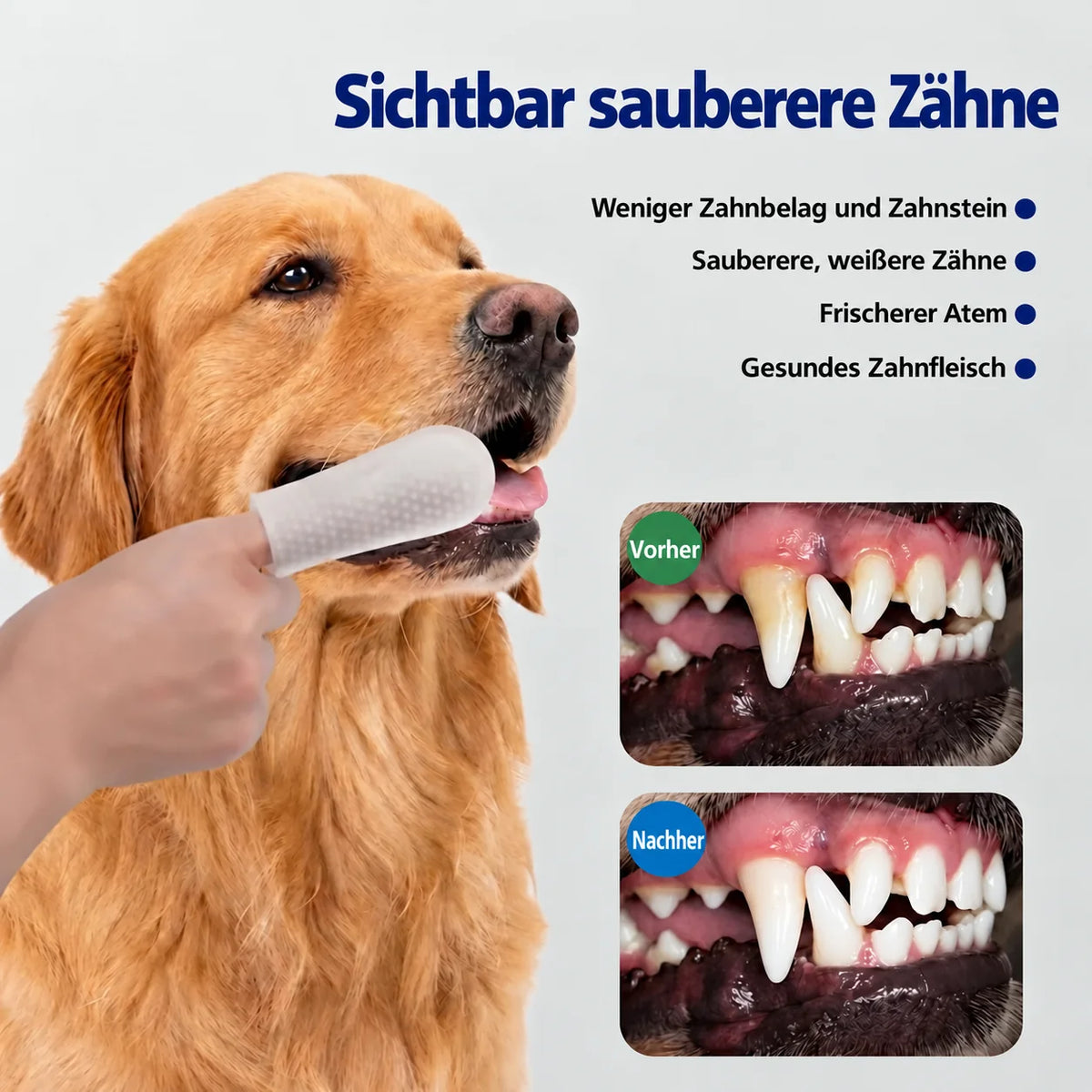 Sichtbar sauberere Zähne, vorher und nachher